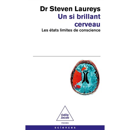 Un si brillant cerveau